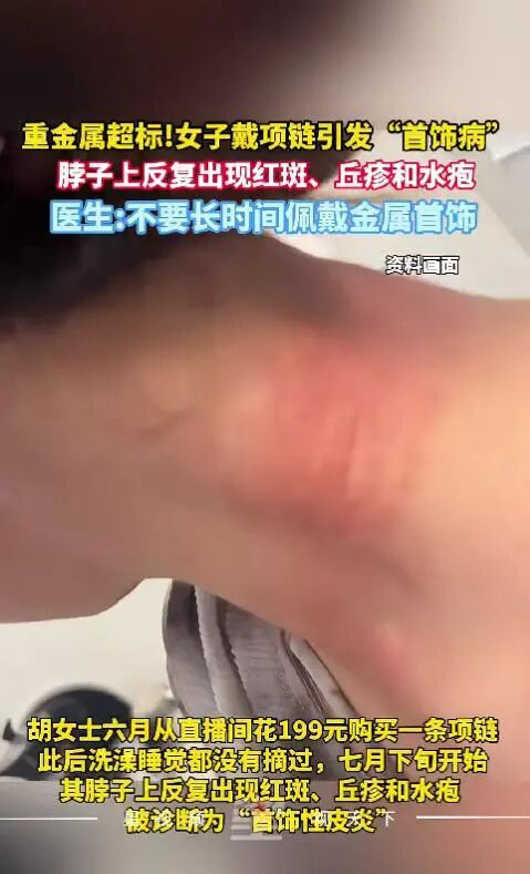 图源：小红书