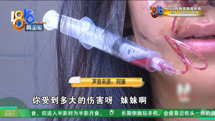 女子坐高铁到杭州应聘KTV工作挣钱治病 最后却成了贷款整容(图25)