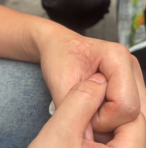 白女士手部照片