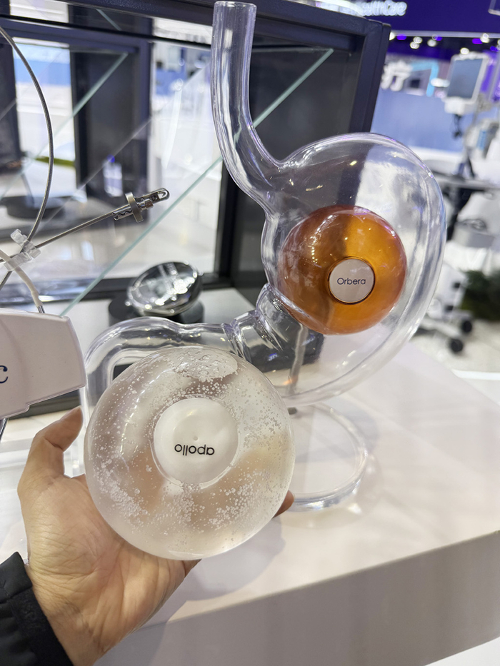 Orbera365球囊。  本文图均为 澎湃新闻记者 陈斯斯 图