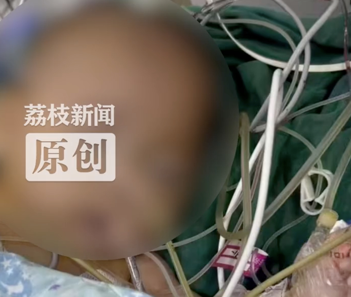 5月龄女婴心脏手术离世眼挂泪痕，医院回应5月龄女婴心脏手术离世