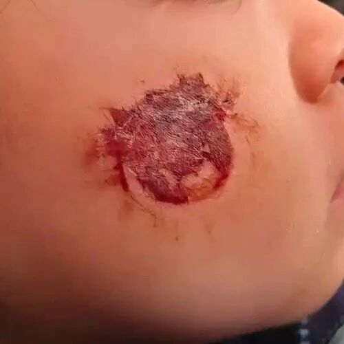 一张贴纸，3岁宝宝“烂脸”！这些常见玩具都暗藏风险→