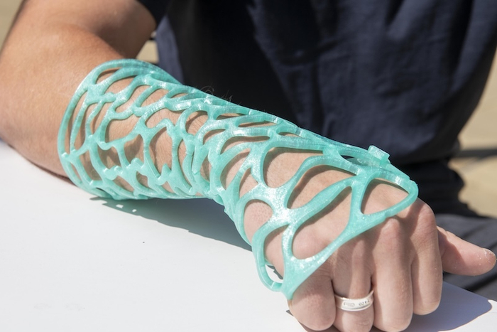 英国诺丁汉特伦特大学的骨科固定系统Morphopaedics