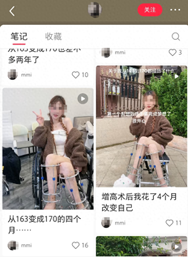 在小紅書(shū)上，仍有宣介“斷骨增高術(shù)”的賬號（截圖）