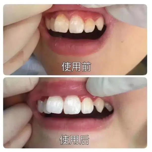 口腔 DR机器怎么用返团 | Dr.wild抛光去渍牙膏,连鹌鹑蛋壳都能刷白,刷一次就能看出差别,一个月就能改变牙齿亮度,好用_新闻资讯_第3张_活检穿刺产品网 口腔 DR机器怎么用返团 | Dr.wild抛光去渍牙膏,连鹌鹑蛋壳都能刷白,刷一次就能看出差别,一个月就能改变牙齿亮度,好用_https://www.jmylbn.com_新闻资讯_第3张