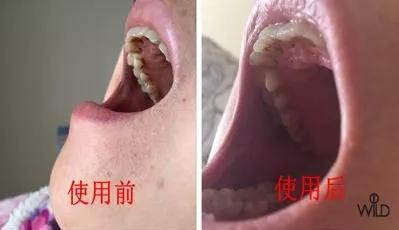 口腔 DR机器怎么用返团 | Dr.wild抛光去渍牙膏,连鹌鹑蛋壳都能刷白,刷一次就能看出差别,一个月就能改变牙齿亮度,好用_新闻资讯_第11张_活检穿刺产品网 口腔 DR机器怎么用返团 | Dr.wild抛光去渍牙膏,连鹌鹑蛋壳都能刷白,刷一次就能看出差别,一个月就能改变牙齿亮度,好用_https://www.jmylbn.com_新闻资讯_第11张