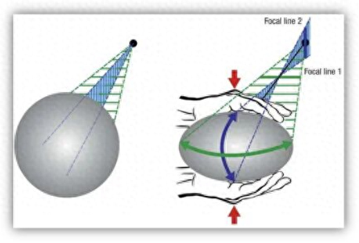 图片来自于Refractive errors. Dtsch Arztebl Int 2016; 113: 693–702