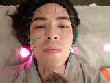 萧敬腾做针灸，脸上扎了数十支针，网友：看照片，脸疼