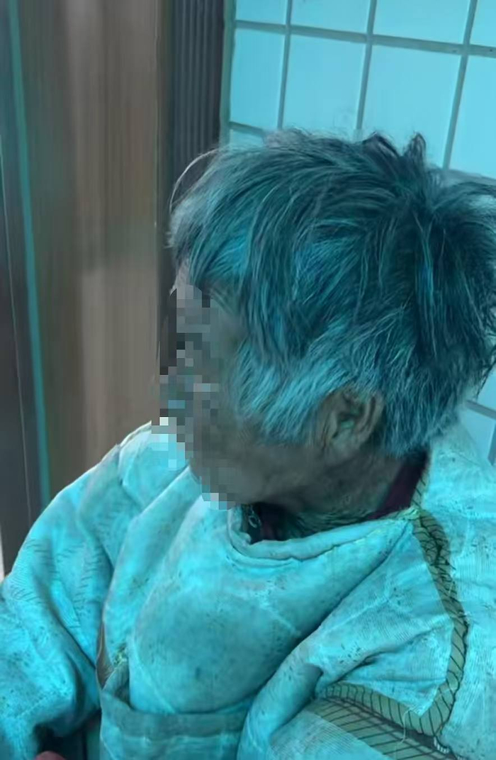 刚被救助时，老人生存状态不佳。受访者供图