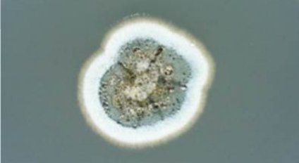 青霉属菌落 图源：中国疾控中心