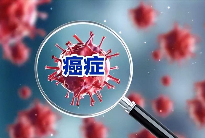 打开网易新闻 查看精彩图片