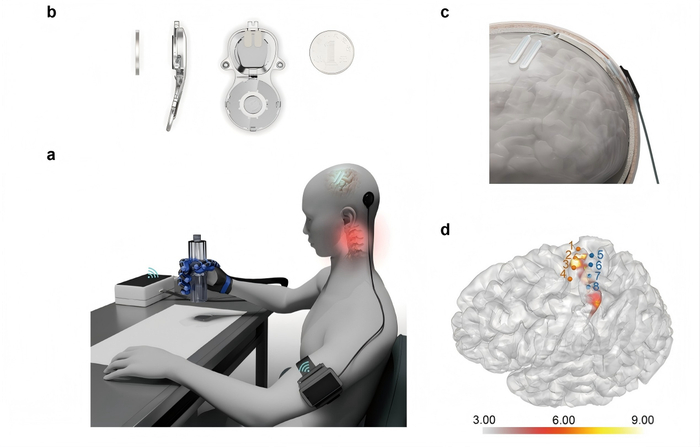 获批上市的首款侵入式脑机接口医疗器械示意图。受访者供图