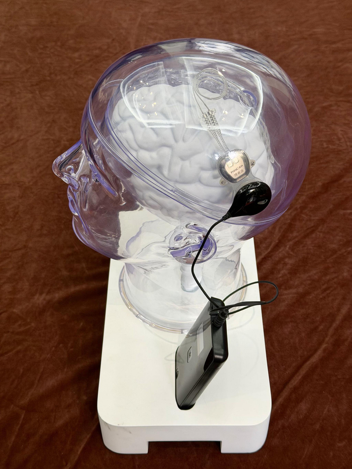 博睿康医疗科技（上海）有限公司植入式脑机接口手部运动功能代偿系统。新京报贝壳财经记者俞金旻 摄