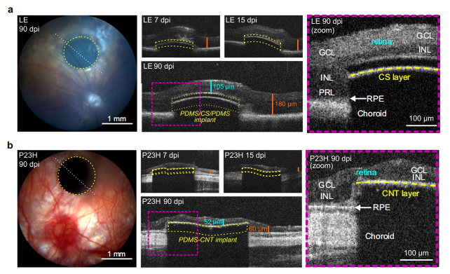 图丨体内光声植入物生物相容性研究（来源：Nature Communications）