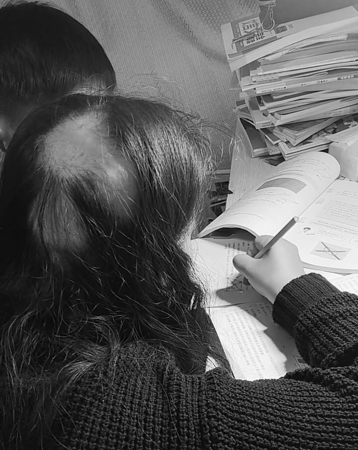 “85后”妈妈辅导作业遭遇“鬼剃头”