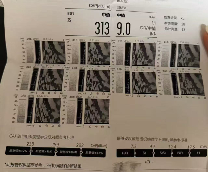  徐琴琴被查出重度脂肪肝。受访者供图