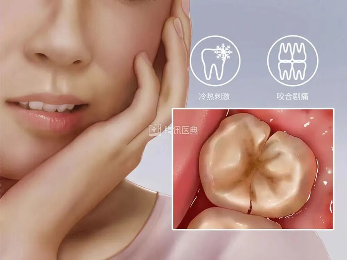 图源：腾讯医典