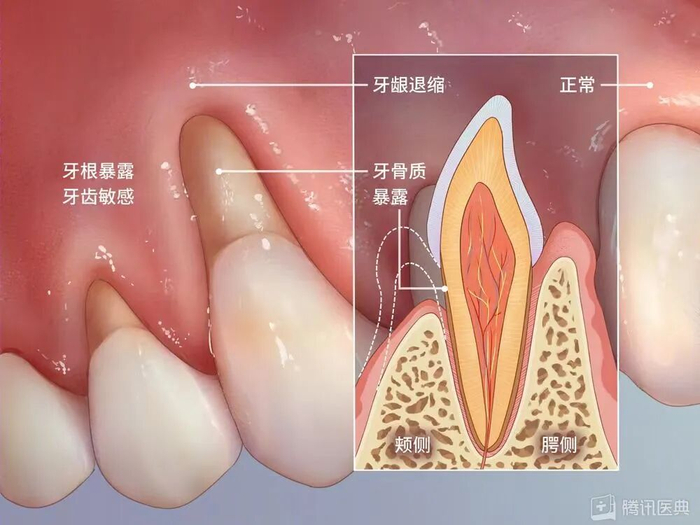 图源：腾讯医典