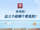 注意！ 手心长痣变大一定要重视