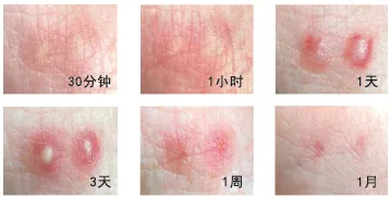 △图源：深圳疾控