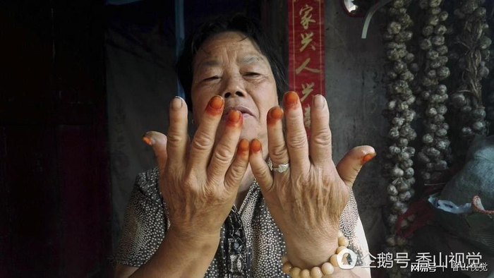  打开网易新闻 查看精彩图片 