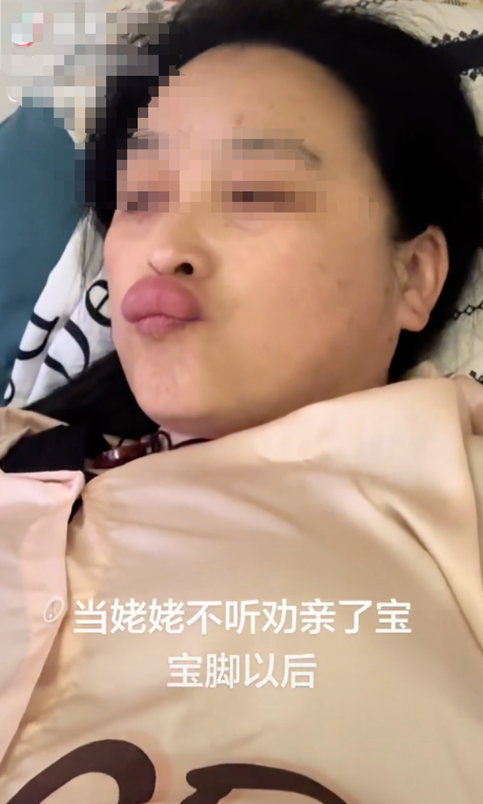 姥姥亲吻婴儿脚丫后，嘴唇红肿如香肠！医生提醒......