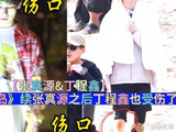 续张真源之后丁程鑫也受伤了 《这是我的岛》