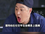 潘玮柏因劳累患上面瘫