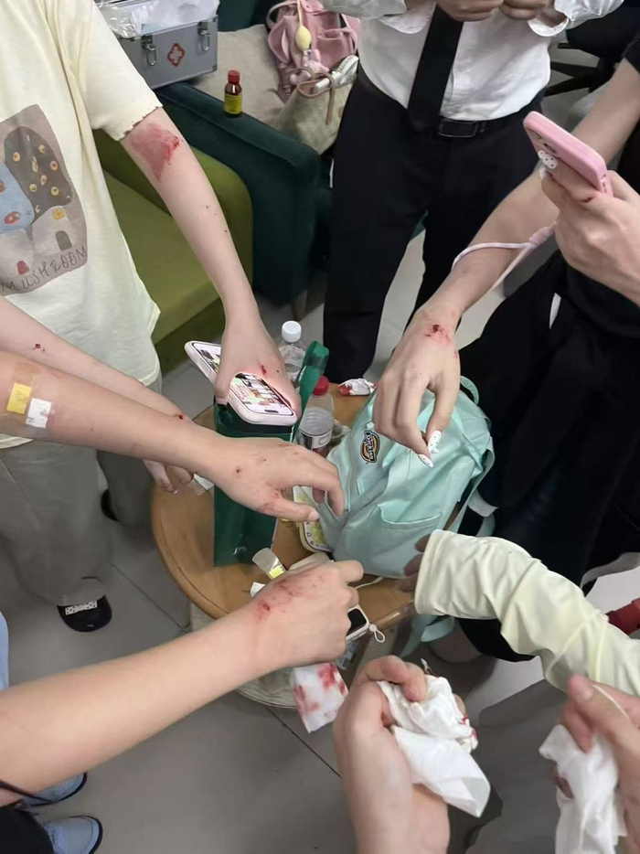 粉丝轻微擦伤 图源来自网络