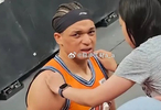 洛夫顿撞胡金秋反伤退！职业球员玻璃体质藏不住了