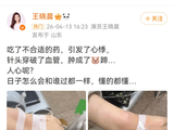 王晓晨称自己吃了不合适的药晒输液照称“日子怎么和会谁过都一样”