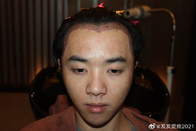 打开网易新闻 查看精彩图片
