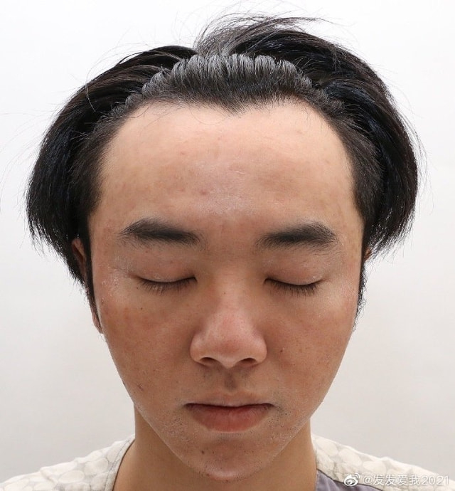 打开网易新闻 查看精彩图片