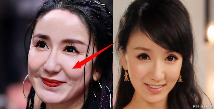     打开网易新闻 查看精彩图片    