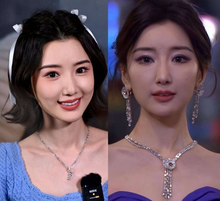 归根结底，女明星的容貌从来都是被放大镜审视的对象。你婴儿肥时有人说你不够精致，你瘦下来又有人说你削骨了；妆容一换就是整容后遗症，素颜一点点憔悴就是do脸失败。毛晓彤这张脸，从17岁到现在，经历了减肥、妆容风格的演变、年龄增长，甚至还有镜头焦段带来的微妙差异，这些因素叠加在一起，视觉上产生变化再正常不过。更何况，她这些年经历了不少风雨，感情的波折、事业的起伏，每一件事都会悄然改变人的气质和气色。至于信不信她整容，其实心里自有一杆秤。但与其纠结她脸上到底有没有动刀，不如多看看她的角色演绎。正如韩国演员孔刘曾说过的：演员的脸是用来表达情感的，不是用来观赏的。毛晓彤能够从当年那个不起眼的小配角，一步步走到如今的一线演员，靠的绝不仅仅是外貌，更重要的，是那股不服输的韧劲和扎实到位的演技。