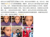 赵本山41岁大女儿近况被曝光！与异母妹妹关系好，私下多次聚餐