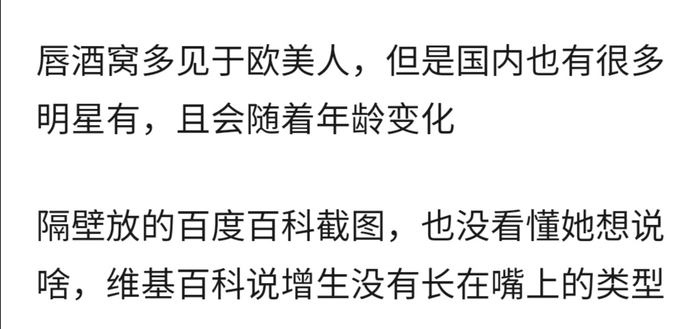     打开网易新闻 查看精彩图片    