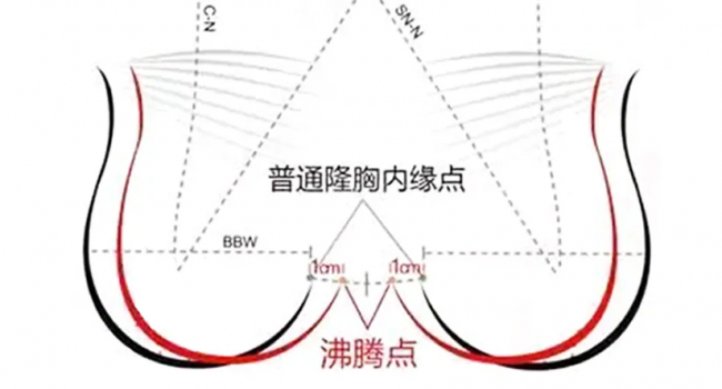 过时的不止网红大胸!现在女生偏爱自然胸型,不穿内衣也有沟还不显假|整形|隆乳|假体|隆胸|沸腾_手机新浪网