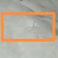 “妈妈，我屁股好痒”，妈妈半夜发现女儿小屁屁上竟有“白色粉末”……送医检查后倒吸一口凉气