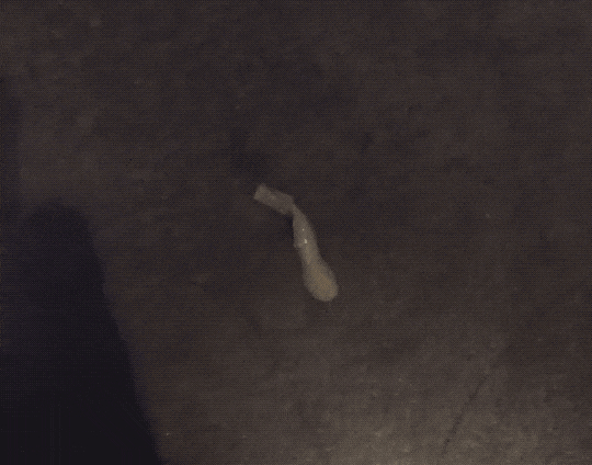 我的菊花里爬出一条绦虫！医生：我从业30年都没见过你这病例__财经头条__新浪财经