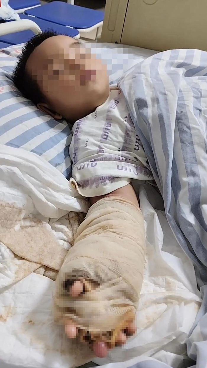 1岁男童家门口遭竹叶青蛇咬伤,家人将毒蛇打死并拍照,母亲:孩子手指发黑、起水泡,仍在住院观察