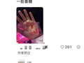 赵雷演唱会上情侣求婚被网友抵制：私人的仪式感，该如何守住不打扰他人的边界？