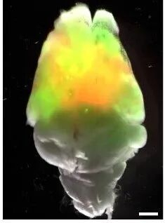一例异种皮质小鼠大脑的俯视图，其中移植了人类脑类器官，这些类器官在移植前已被标记为绿色和红色。图片来源：斯坦福大学Pasca实验室