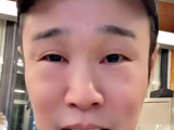 小沈阳眼睛肿成蜜蜂小狗，仍给李光洁做土豆茄子