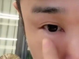 “一觉醒来，肿成蜜蜂小狗了”小沈阳公演前突发眼肿，发文提醒大家看《披荆斩棘 2026》公演时做好心理准备