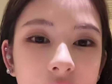 梅尼耶被妻子整容前照片吓到，黄婉均整容后变网红脸