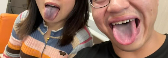 用餐后出现舌苔发黑现象。图/受访者提供
