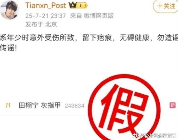 田栩宁回应灰指甲质疑称系旧伤疤痕