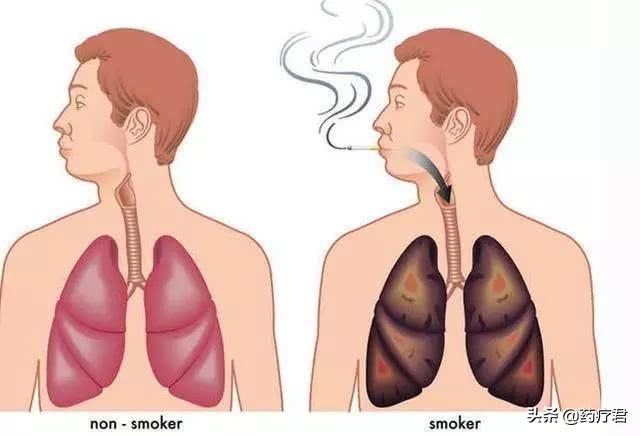 一天一包烟和三天一包烟,哪个伤害更大?人体一天能承受几支烟?