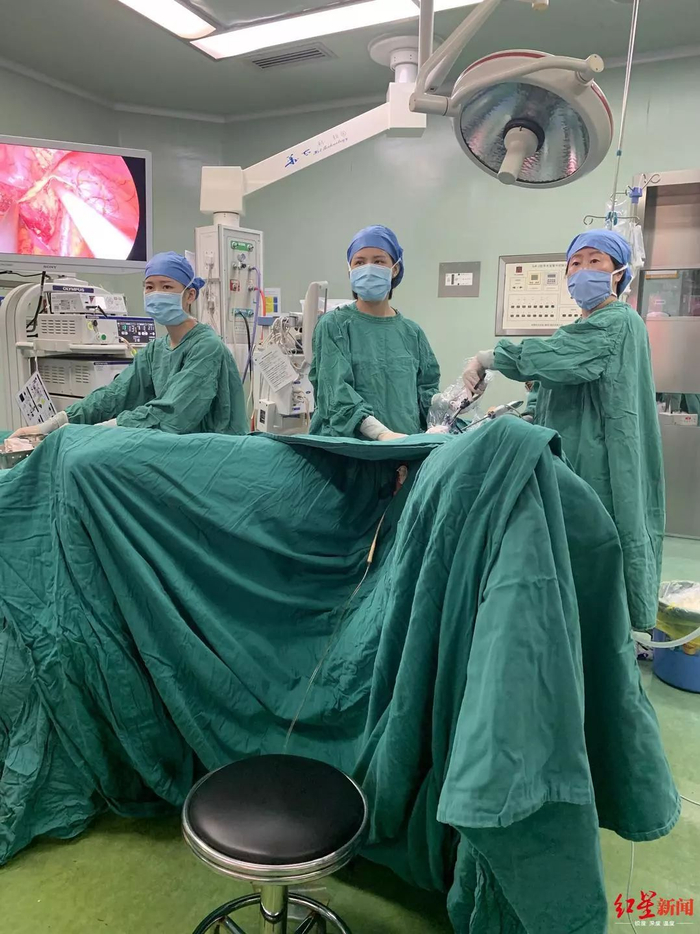 ↑通过单孔腹腔镜，在为患者切除肿瘤时顺利取出卵巢